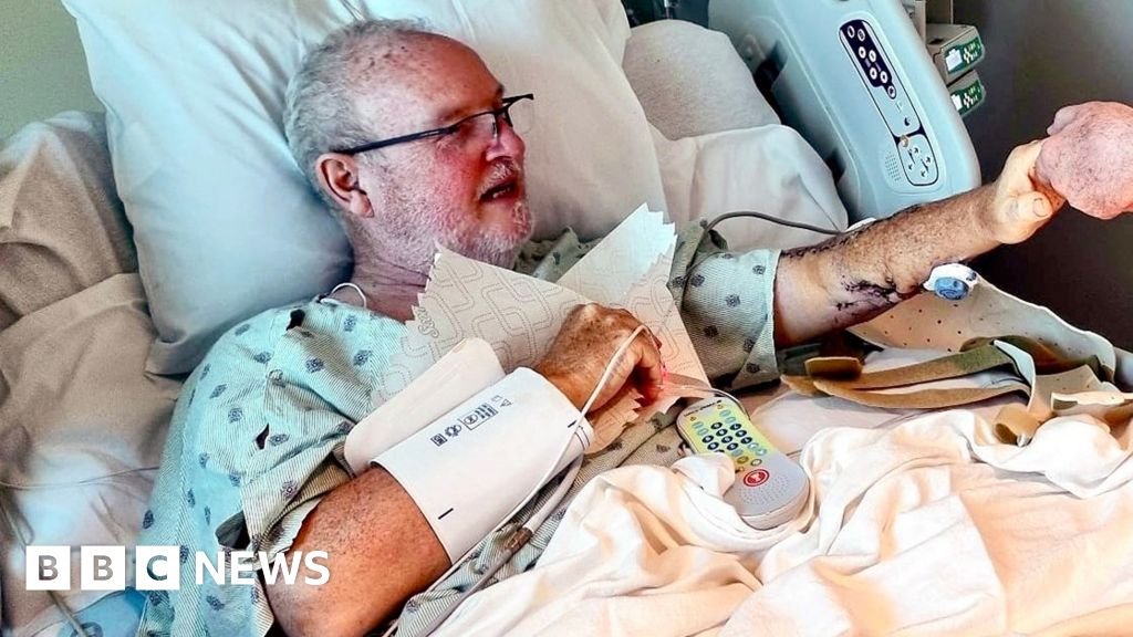 'I've never hit anything so hard': What it's like to be attacked by a shark